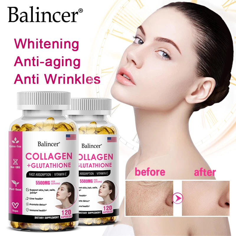 glutathione and collagen pills Luxxe White Ultima + 1400 mg 60 Capsules Suppleme  My Care Kits Belo Glutathione Capsules with Collagen