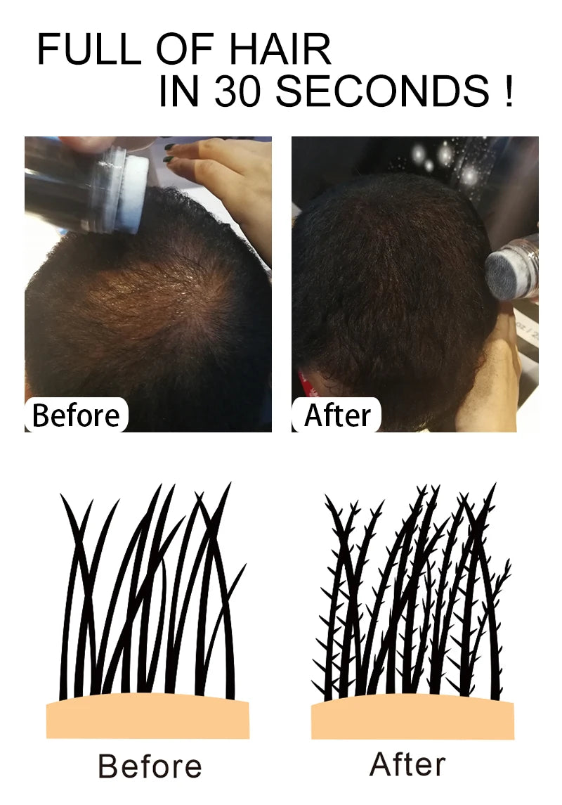 Sevich Hair Building Fiber Applicator Spray Instant Salon Hair Treatment Keratin Powders Hair Regrowth Fiber Thickening 10 Color