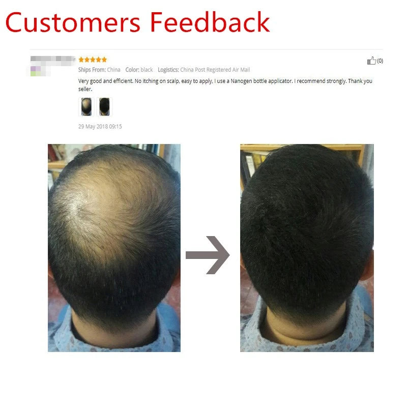 Sevich Hair Building Fiber Applicator Spray Instant Salon Hair Treatment Keratin Powders Hair Regrowth Fiber Thickening 10 Color