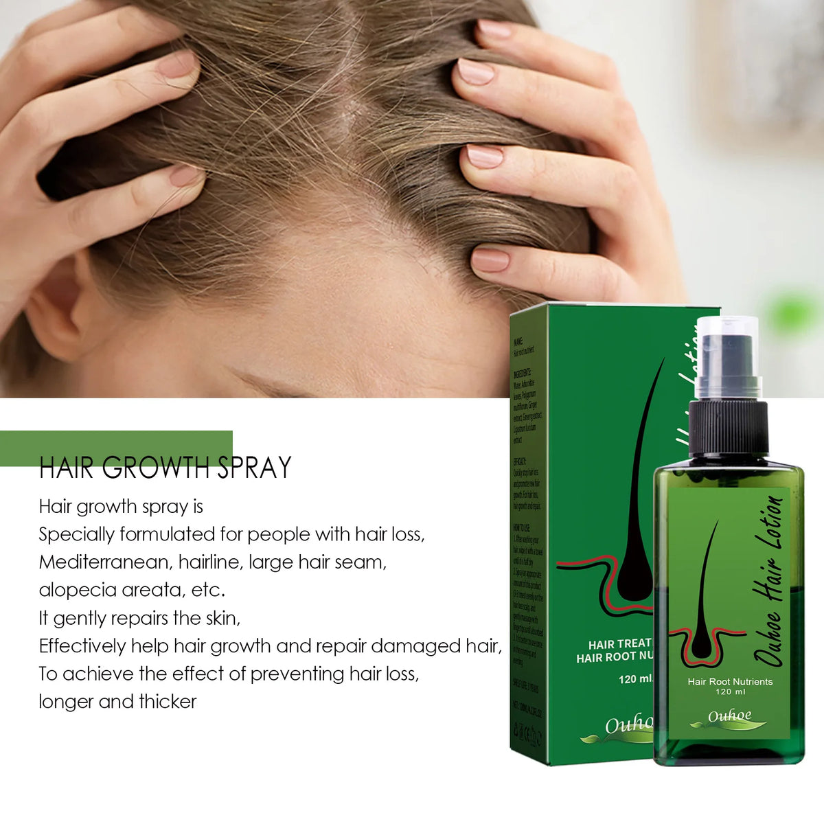 Hair Regrowth For Man Hair Growth Spray Anti Hair Loss Baldness Hair Root Repair Damaged Scalp Treatment Hair Growth Serum New