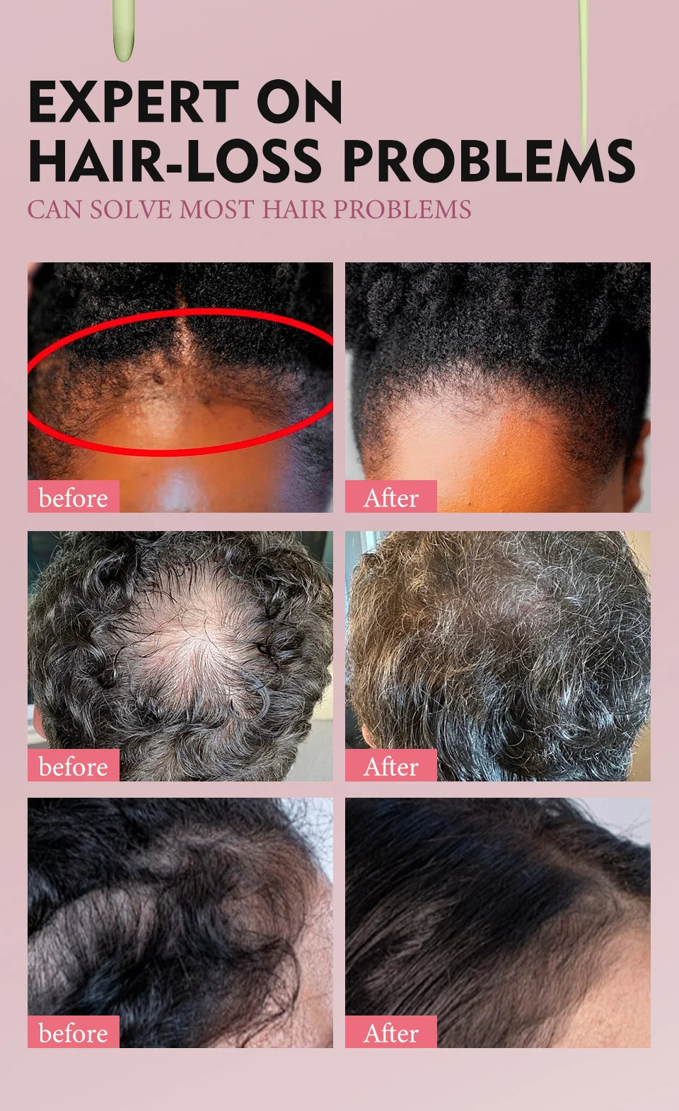 100% Pure Natural Karkar Chebe Oil Batana Butter Hair Growth Oil Rosemary Repair Damaged Hair Treatment Oil Anti-Hair Loss Care