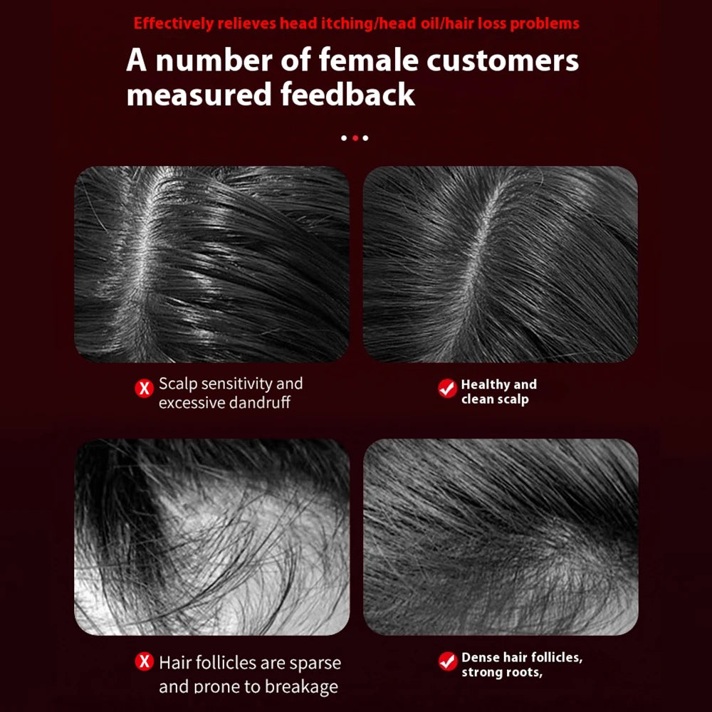 Electric Scalp Massage Comb with Red Light – Hair Growth Brush