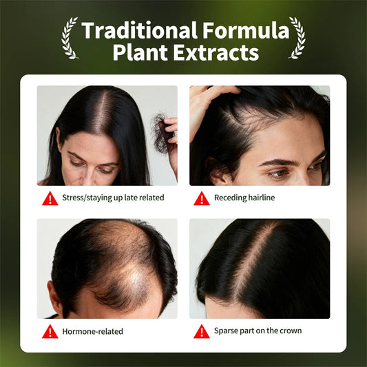Anti Hair Loss Serum Set Hair Growth Essential Oil Usman Hair Regrowth Shampoo Soap Hair Care Thickening Oil Spray For Men Women