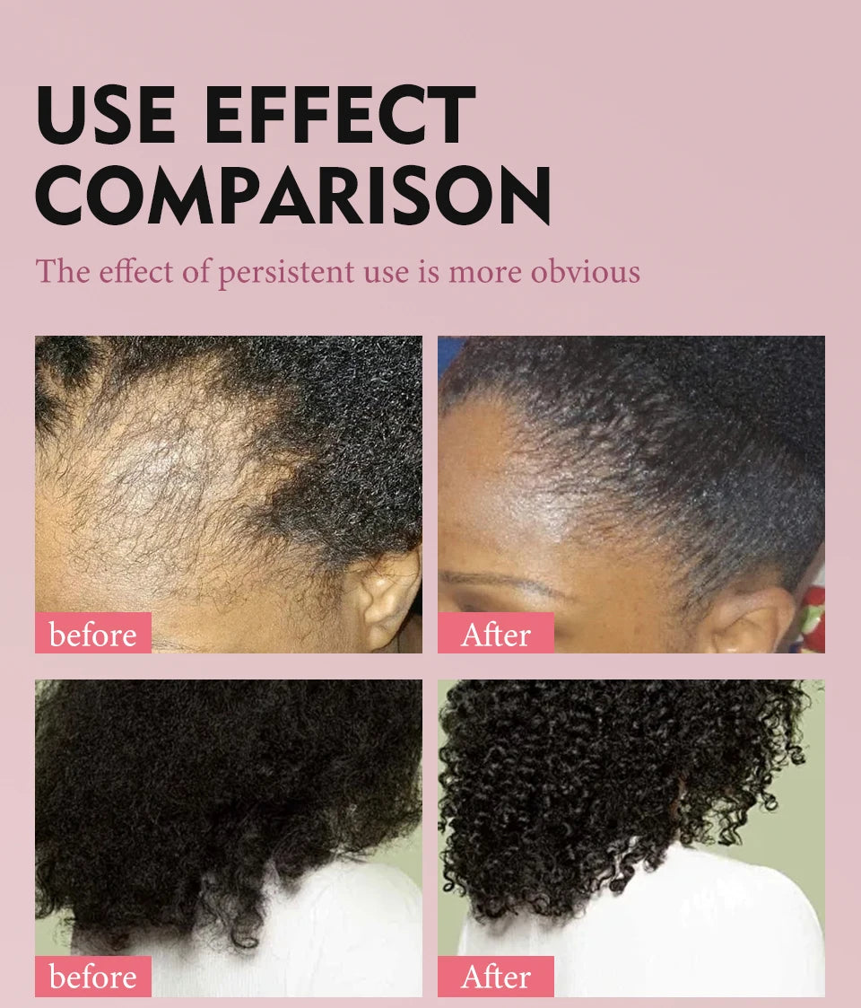 100% Pure Natural Karkar Chebe Oil Batana Butter Hair Growth Oil Rosemary Repair Damaged Hair Treatment Oil Anti-Hair Loss Care