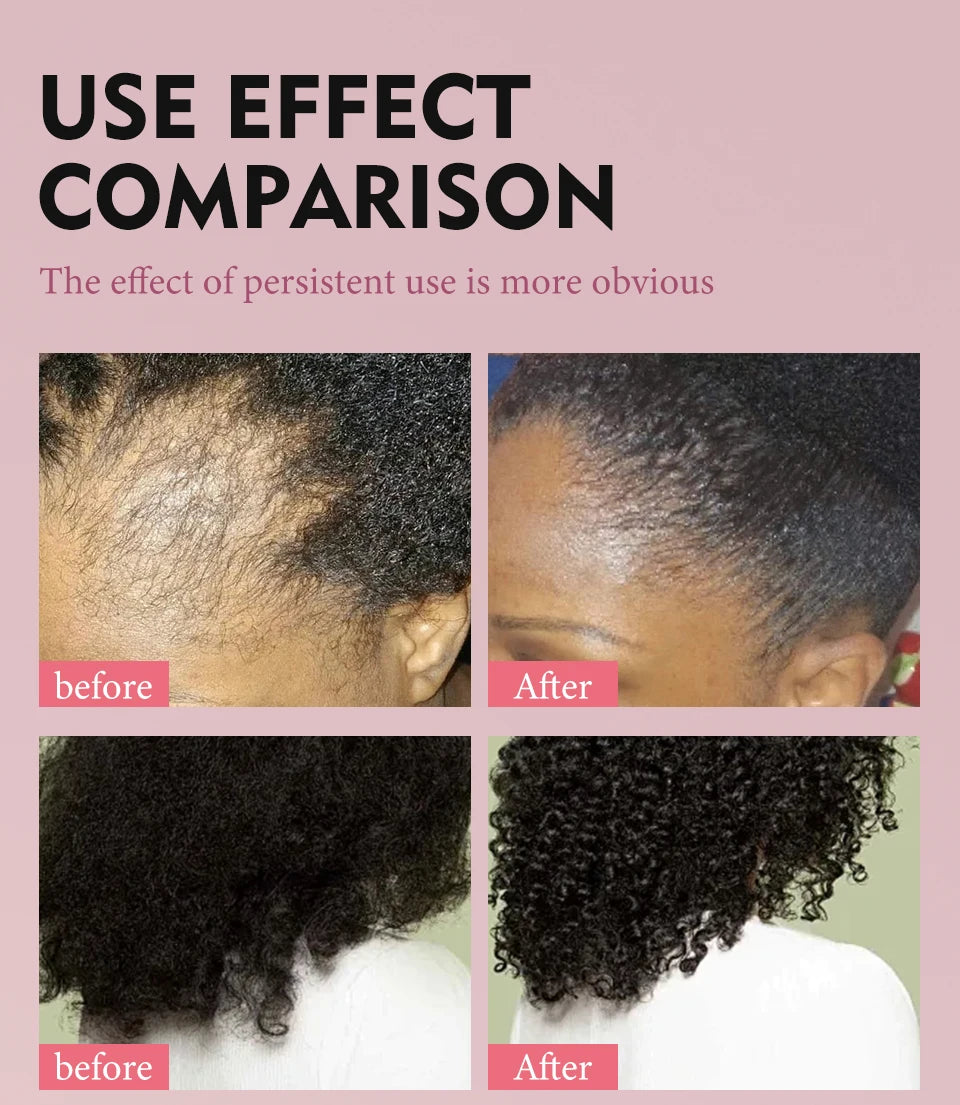 100% Pure Natural Karkar Chebe Oil Batana Butter Hair Growth Oil Rosemary Repair Damaged Hair Treatment Oil Anti-Hair Loss Care