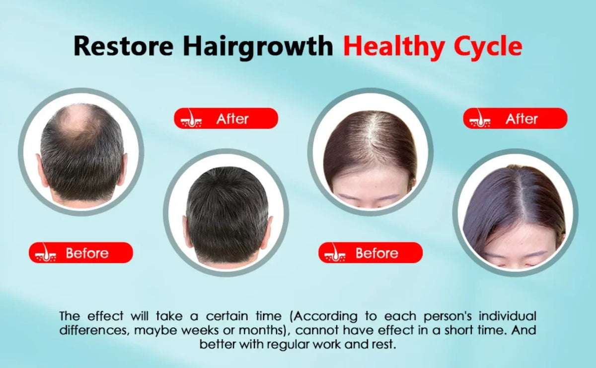 Hair Growth Cap Rechargeable 2000mAh LED Health Light Device Anti Hair Loss Anxiety Stress Reduce Migraine Scalp Relax Massager