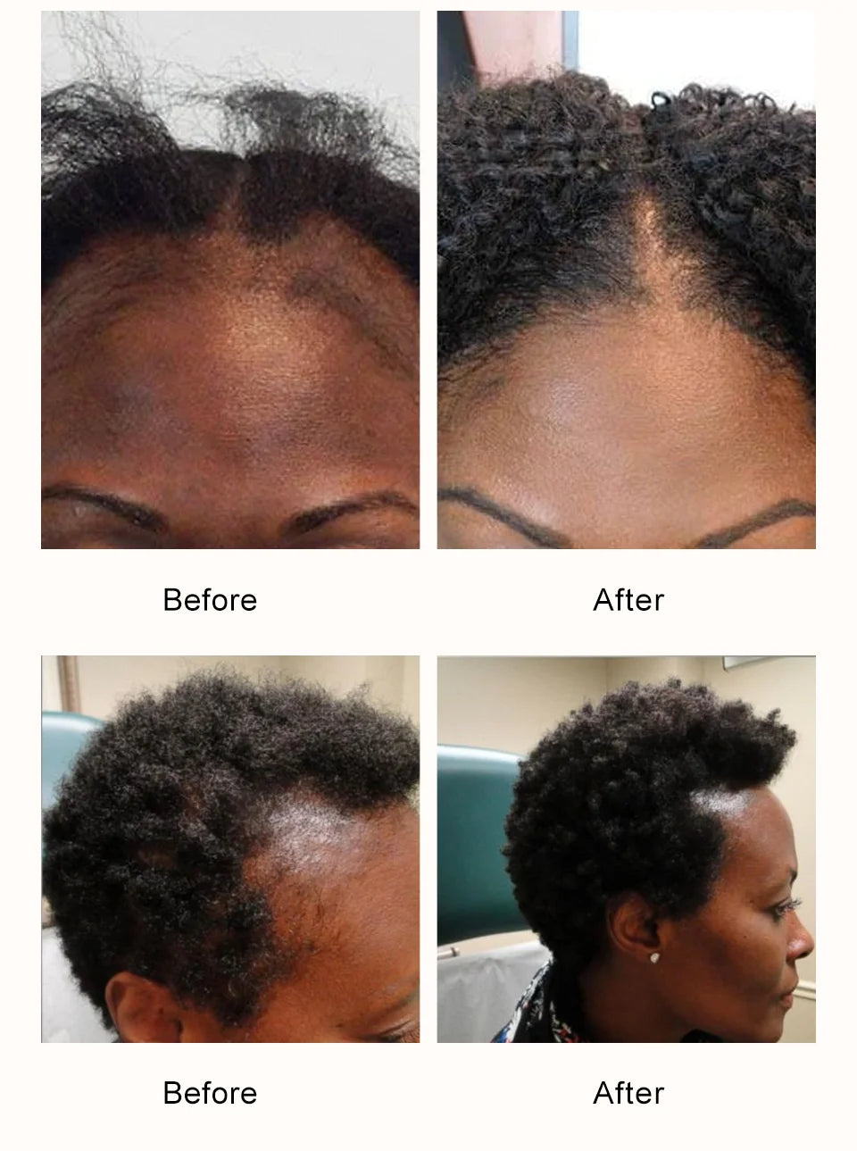 100% Chebe Powder Natural Ingredients Promotes Strong and Healthy Hair Strengthens Fast Hair Regrowth Anti Hair Loss Treatment