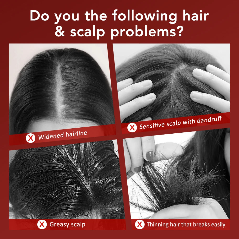 Electric Scalp Massage Comb with Red Light – Hair Growth Brush