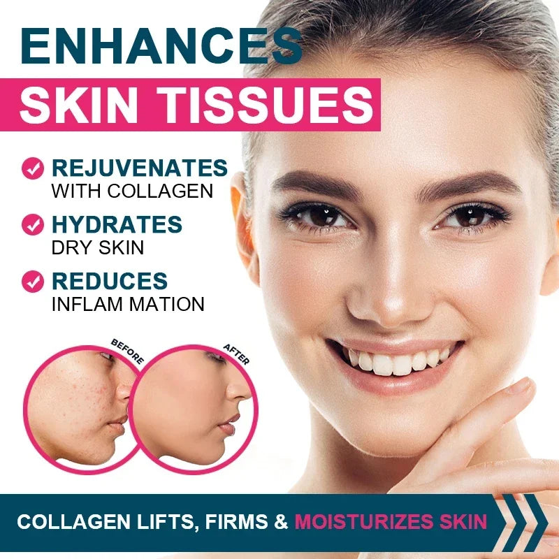 Multi Collagen Complex Capsules – Types I II III V X | Hair Skin Nails