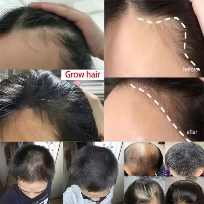 Rosemary Hair Growth Oil Anti Hairs Loss Treatment Mint Hair Strengthening Oil Nourishing Roots Regrowth Hair For Men Women 50ml