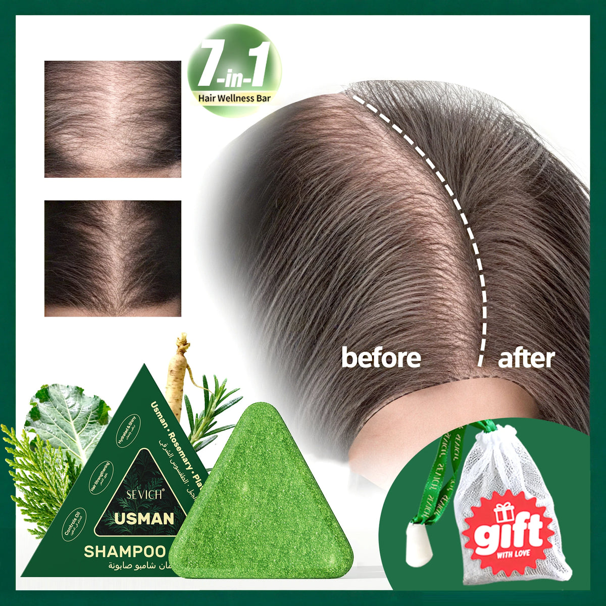 Anti Hair Loss Serum Set Hair Growth Essential Oil Usman Hair Regrowth Shampoo Soap Hair Care Thickening Oil Spray For Men Women